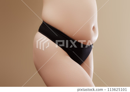 Cropped image of overweight fat naked woman with 113625101