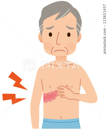 男性因帶狀皰疹而感到疼痛的症狀 113651457