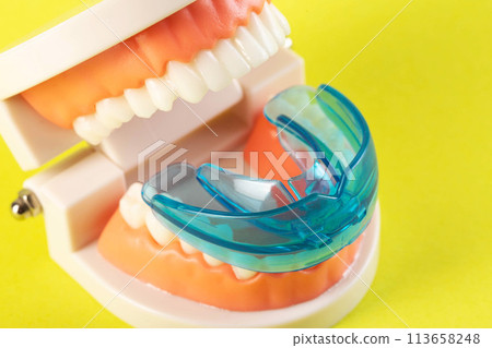 Therapeutic mouthguard on the background of a dental jaw mockup on a yellow background. Treatment of teeth grinding, bruxism in children and adults. Protecting tooth enamel from abrasion when grinding Therapeutic mouthguard on the background of a dental jaw mockup on a yellow background. Treatment of teeth grinding, bruxism in children and adults. Protecting tooth enamel from abrasion when grinding 113658248