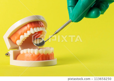 The hand of a dentist doctor in a green medical glove holds a dental mirror in his hand near a mock-up of a dental jaw on a yellow background. Concept of wisdom teeth removal, gum inflammation, molar 113658250