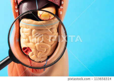 Mockup of a man with internal organs and intestines under a magnifying glass on a blue background. Concept of intestinal diseases and treatment, cancer and intestinal polyps. Flatulence and bloating. 113658314