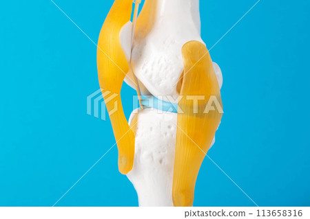 Medical mockup of the knee joint on a blue background, close-up. Concept of knee treatment with arthroscopic surgery. Knee replacement. Medical mockup of the knee joint on a blue background, close-up. Concept of knee treatment with arthroscopic surgery. Knee replacement. 113658316