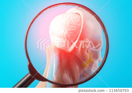 Medical model of a human head with a brain under a magnifying glass. Concept of brain diseases, stroke, dizziness. Headache and Parkinson's disease, close-up Medical model of a human head with a brain under a magnifying glass. Concept of brain diseases, stroke, dizziness. Headache and Parkinson's disease, close-up 113658703