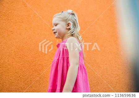 Child with hearing problem and cochlear implant have fun in street, deaf kid began to hear. Hearing loss in childhood and treatment concept. Copy space and empty place for text. Inclusion Child with hearing problem and cochlear implant have fun in street, deaf kid began to hear. Hearing loss in childhood and treatment concept. Copy space and empty place for text. Inclusion 113659636