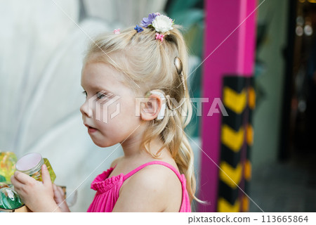 Child walks with cochlear implant hearing aid in summer street close-up. Inclusion and modern technologies for treating hearing loss. Copy space 113665864