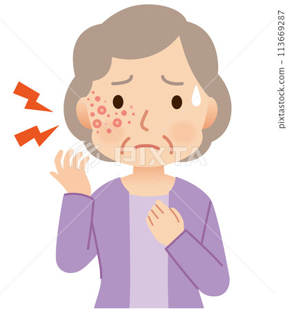 Elderly woman suffering from pain due to shingles Symptoms 113669287