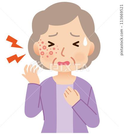 Elderly woman suffering from pain due to shingles Symptoms 113669521