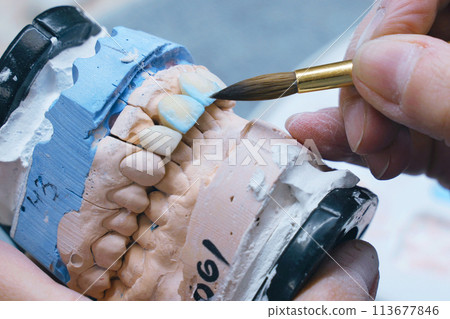 A dental technician paints a denture with a brush. A dental technician paints a denture with a brush. 113677846