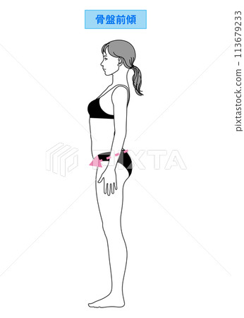 骨盆前傾 骨盆向前傾斜的不良姿勢 日本女性站立的插圖 全身側向側面 113679233