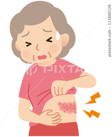 Elderly woman suffering from pain due to shingles Symptoms Elderly woman suffering from pain due to shingles Symptoms 113680126