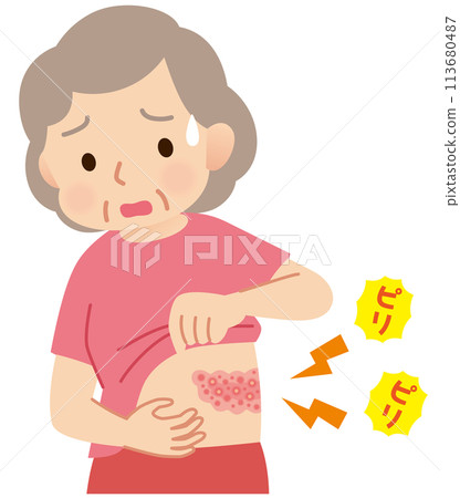 Elderly woman suffering from pain due to shingles Symptoms Elderly woman suffering from pain due to shingles Symptoms 113680487