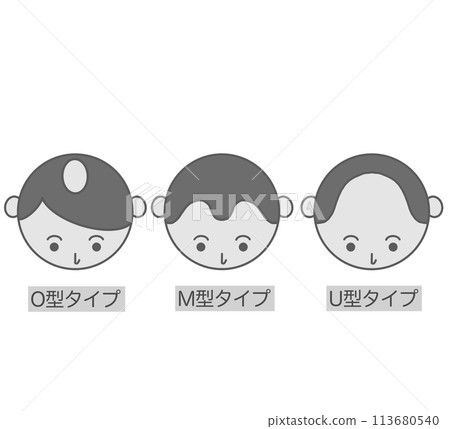 Hair disease Skin disease People with thinning hair 113680540