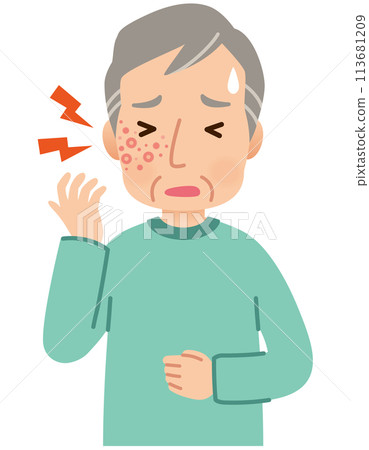 Elderly man suffering from pain due to shingles Symptoms Elderly man suffering from pain due to shingles Symptoms 113681209