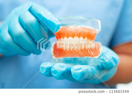 Denture, dentist holding dental teeth model to study and treat in hospital. Denture, dentist holding dental teeth model to study and treat in hospital. 113683349
