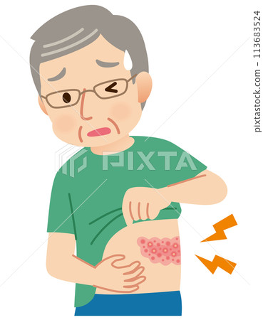 Elderly man suffering from pain due to shingles Symptoms Elderly man suffering from pain due to shingles Symptoms 113683524