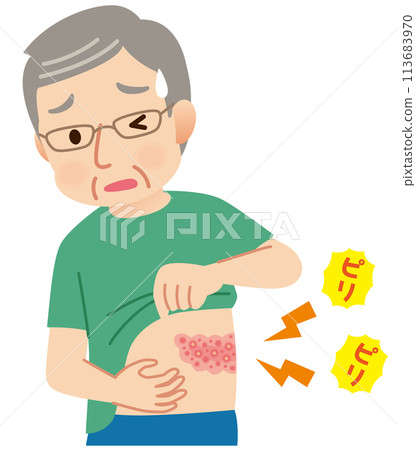 Elderly man suffering from pain due to shingles Symptoms Elderly man suffering from pain due to shingles Symptoms 113683970