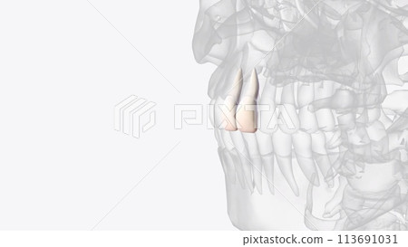 The maxillary central incisor is a human tooth in the front upper jaw, or maxilla The maxillary central incisor is a human tooth in the front upper jaw, or maxilla 113691031