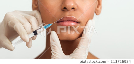 Close-up view of filler injection in lips Close-up view of filler injection in lips 113716924