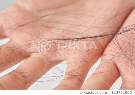 失去頭髮的女人的手 失去頭髮的女人的手 113721900