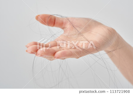 失去頭髮的女人的手 失去頭髮的女人的手 113721908