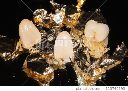 I want to have beautiful teeth at the dentist I want to have beautiful teeth at the dentist 113740393