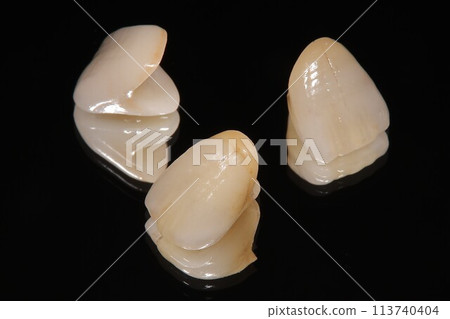 I want to have beautiful teeth at the dentist 113740404