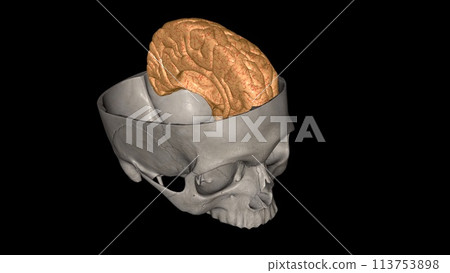 The left cerebral hemisphere controls movement of the right side of the body 113753898