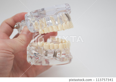 Demonstration model of a human jaw 113757341