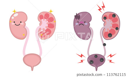 泌尿和腎臟特徵 泌尿和腎臟特徵 113762115