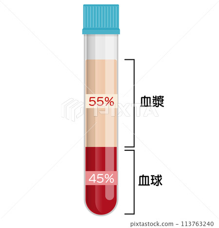 Blood samples 113763240