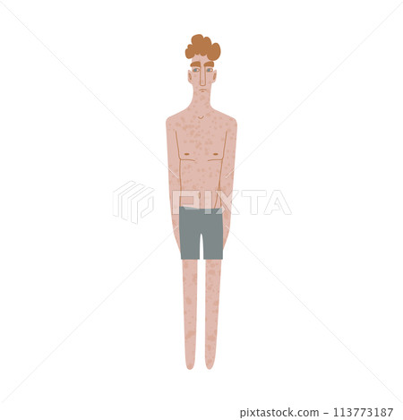 Flat Irish man in underwear. Pale ad freckled skin person with redhead in cartoon style for multinational and diversity designs. Vector illustration. Flat Irish man in underwear. Pale ad freckled skin person with redhead in cartoon style for multinational and diversity designs. Vector illustration. 113773187