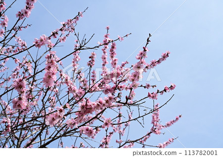 Almond (Rosaceae, Prunus genus) tonsils 113782001