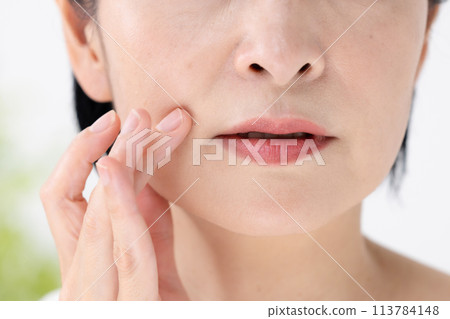 Beauty, Nasolabial folds, Concerns 113784148