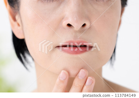 Beauty, Nasolabial folds, Concerns Beauty, Nasolabial folds, Concerns 113784149