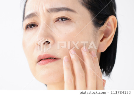Beauty, Nasolabial folds, Concerns 113784153