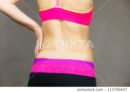 Woman with medical kinesio taping on back 113786607