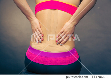 Woman with medical kinesio taping on back 113786609