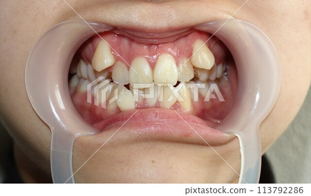 A woman who cares about her teeth 113792286