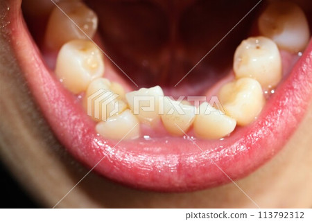 A woman who cares about her teeth 113792312