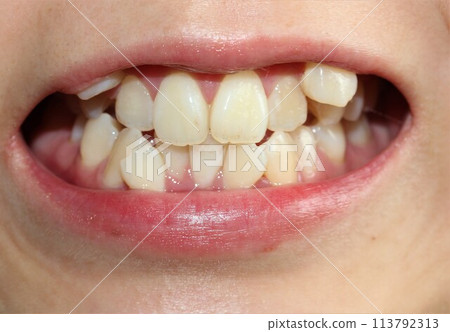 A woman who cares about her teeth 113792313