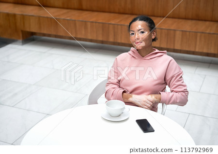 Black african american woman with vitiligo 113792969