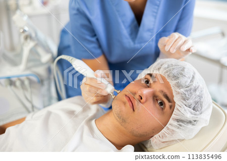 woman is using RF lifting 113835496