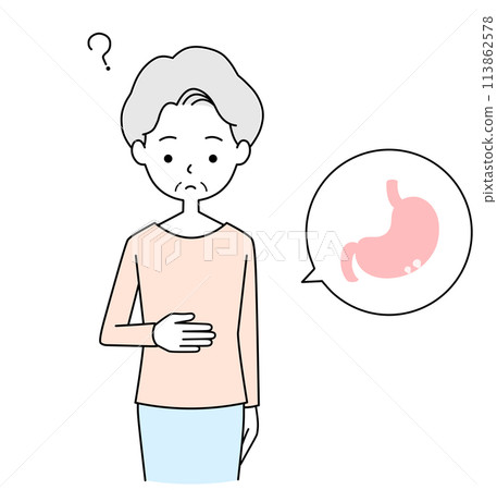 一位患有良性胃息肉且無症狀的老年婦女的插圖 一位患有良性胃息肉且無症狀的老年婦女的插圖 113862578