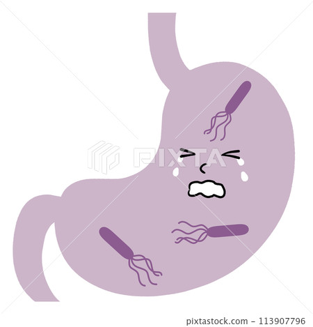胃與幽門螺旋桿菌的插圖 113907796