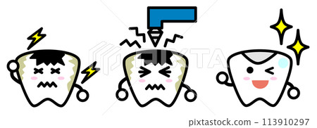 經過牙醫治療蛀牙後變得美麗的牙齒的插圖 經過牙醫治療蛀牙後變得美麗的牙齒的插圖 113910297