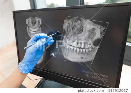 Dental consultation with 3D tomography image 113912027