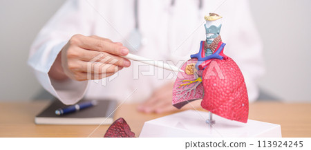 Doctor with Smoker and normal Lung anatomy for Disease. Lung Cancer, Asthma, Chronic Obstructive Pulmonary or COPD, Bronchitis, Emphysema, Cystic Fibrosis, Bronchiectasis, Pneumonia and world Lung day Doctor with Smoker and normal Lung anatomy for Disease. Lung Cancer, Asthma, Chronic Obstructive Pulmonary or COPD, Bronchitis, Emphysema, Cystic Fibrosis, Bronchiectasis, Pneumonia and world Lung day 113924245
