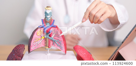 Doctor with Smoker and normal Lung anatomy for Disease. Lung Cancer, Asthma, Chronic Obstructive Pulmonary or COPD, Bronchitis, Emphysema, Cystic Fibrosis, Bronchiectasis, Pneumonia and world Lung day 113924600
