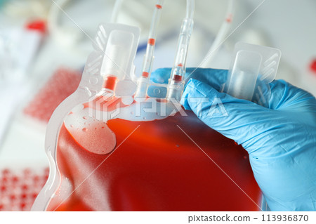 Bag with donor blood in doctor's hand on light background, close up 113936870