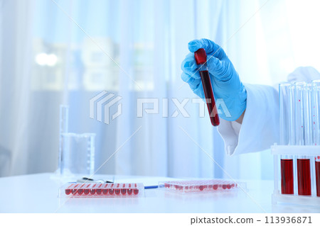 Test tubes with donor blood in doctor's hand on light background, space for text Test tubes with donor blood in doctor's hand on light background, space for text 113936871